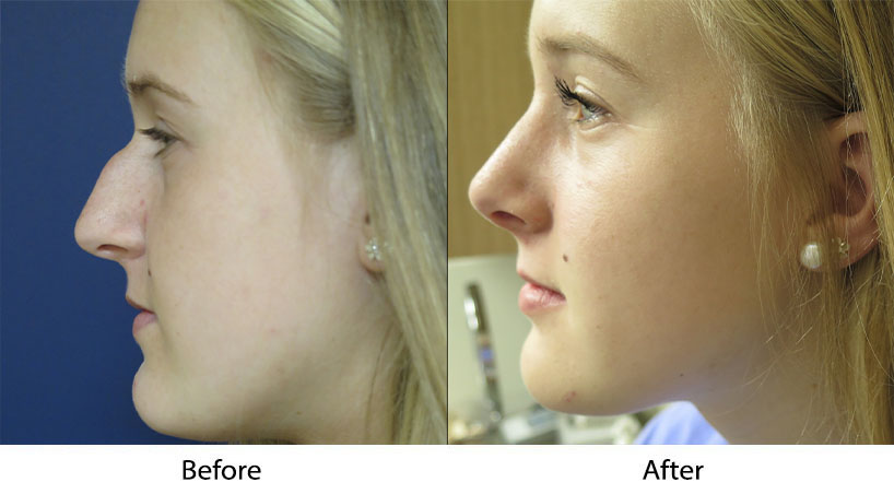 https://techafar.com/how-facial-surgery-can-improve-your-facial-harmony/