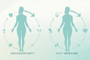 Abdominoplasty with Liposuction: Get a Flat Tummy Now